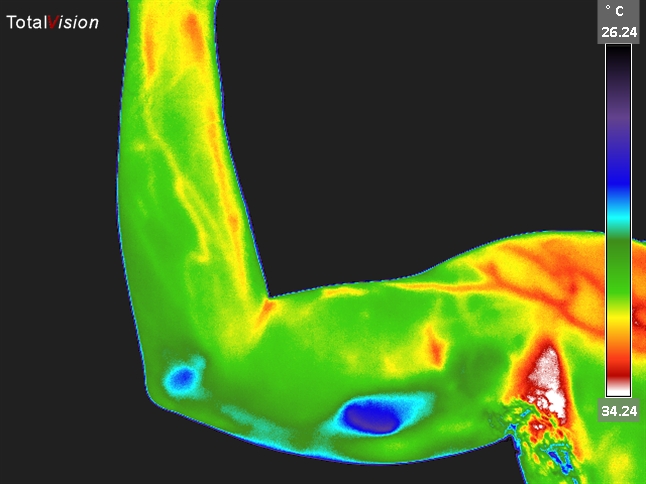 Thermal image of an arm.