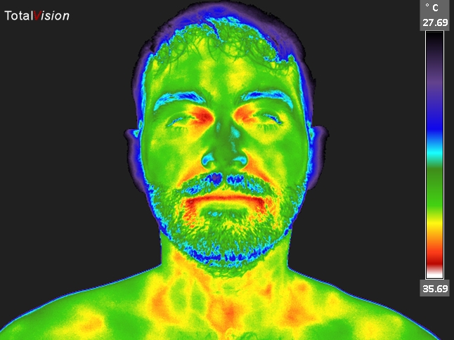 Thermal image of a face.